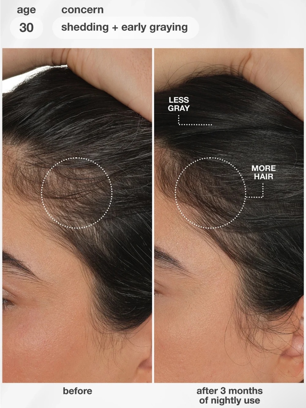 K18 FutureIQ™ Hair Longevity Serum for Graying, Thinning, & Scalp Aging - Picture 3 of 6